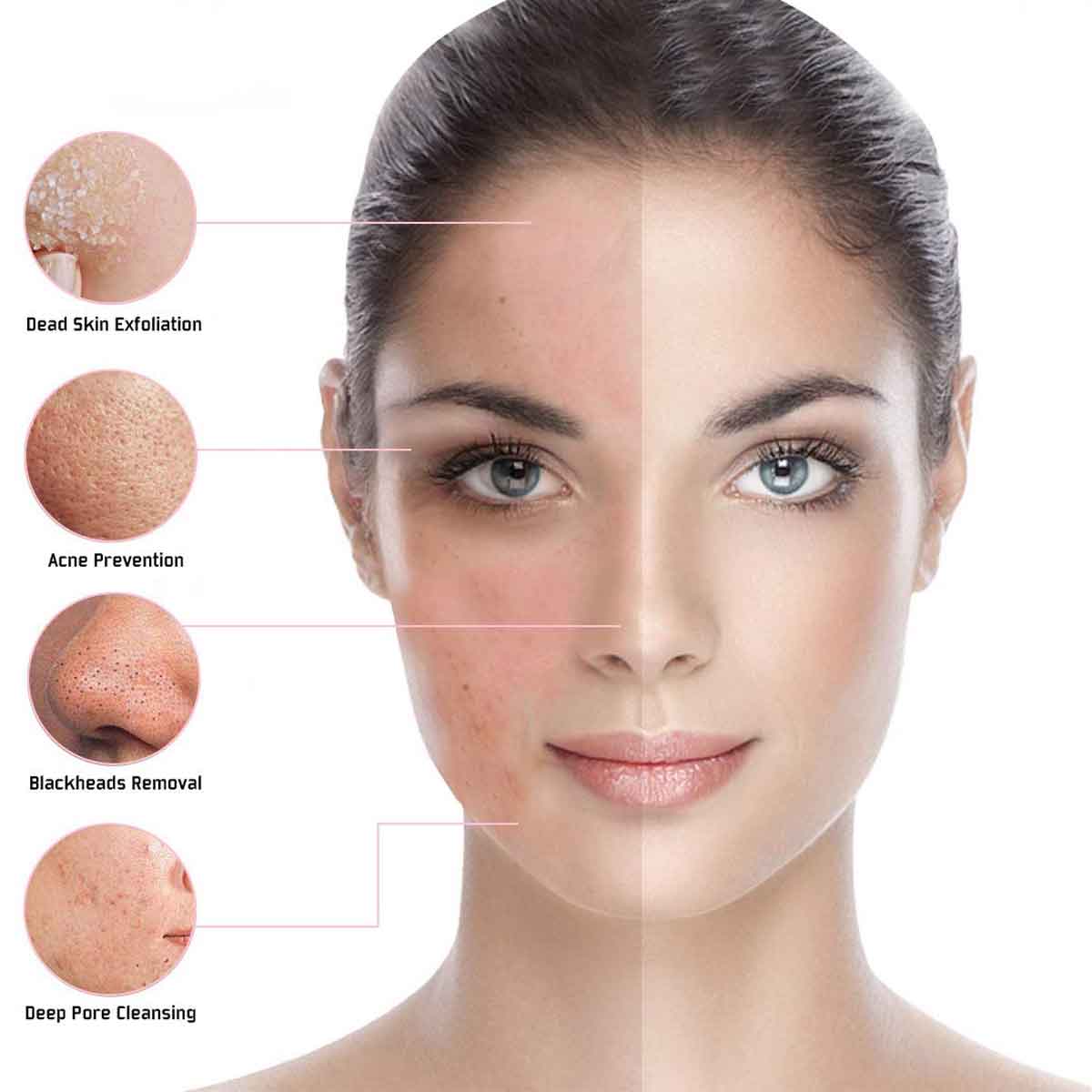 RF Facial Photon LED Skin Care Beauty Device for Home