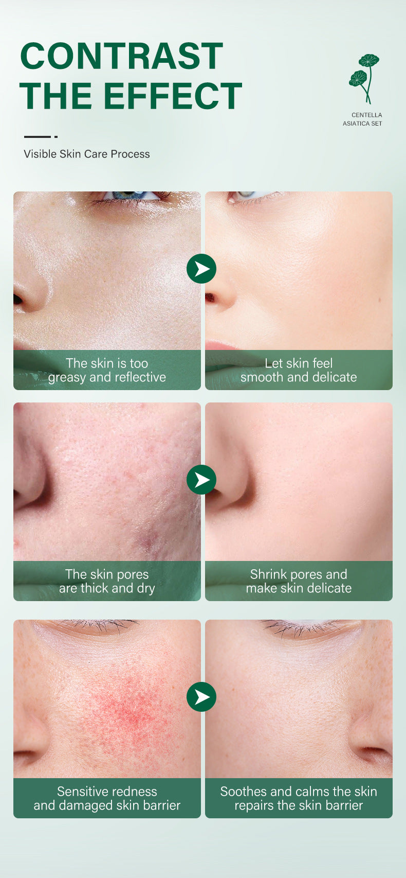 Centella Natural Skin Care Set